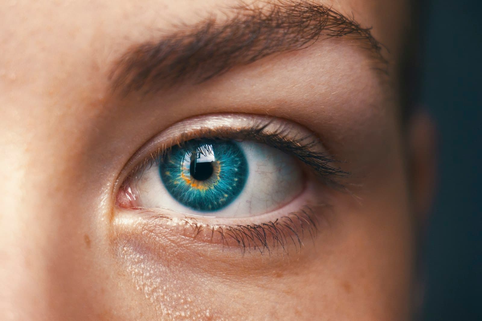 Ojeras