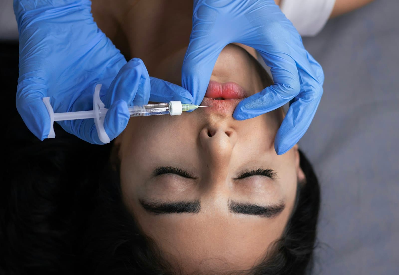 Botox